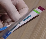 Hanoi police investigate HIV test strip scandal