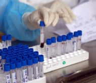 Vietnam starts research for Covid-19 vaccine